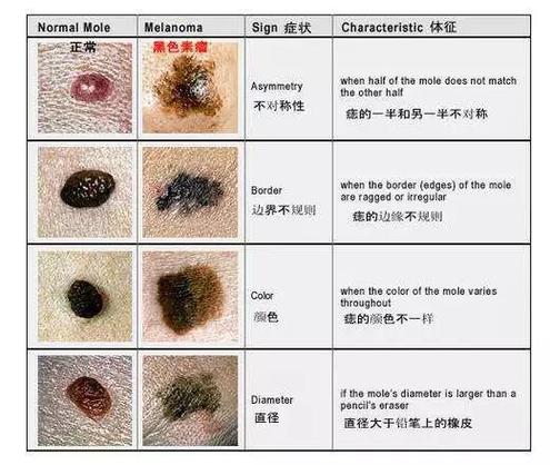 揭秘貓咪神秘的黑斑，背后的故事與科學(xué)