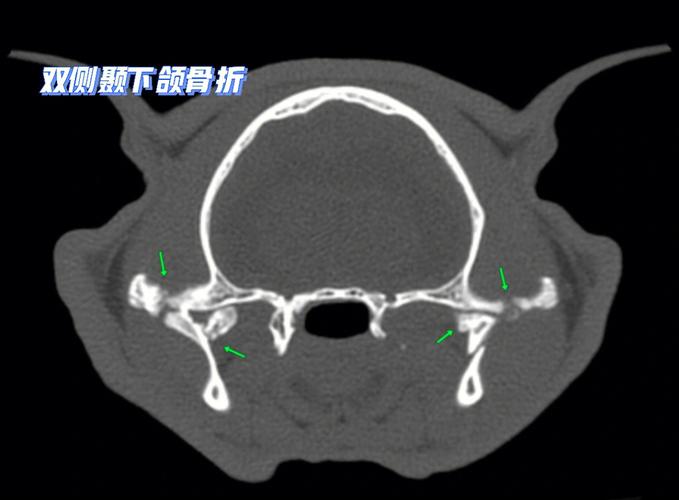 貓咪嘴巴骨折，了解常見癥狀與緊急處理方法