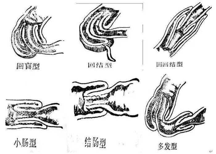 揭秘貓咪腸套結(jié)，了解這種疾病及其對貓咪的影響