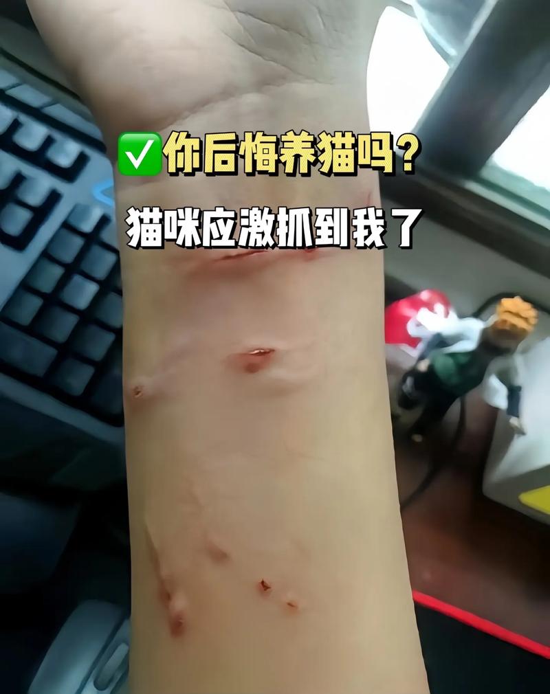 貓爪下的秘密，如何正確處理貓咪咬傷