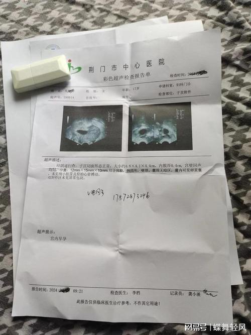 揭秘貓咪妊娠的蛛絲馬跡，如何正確進(jìn)行妊娠檢測(cè)