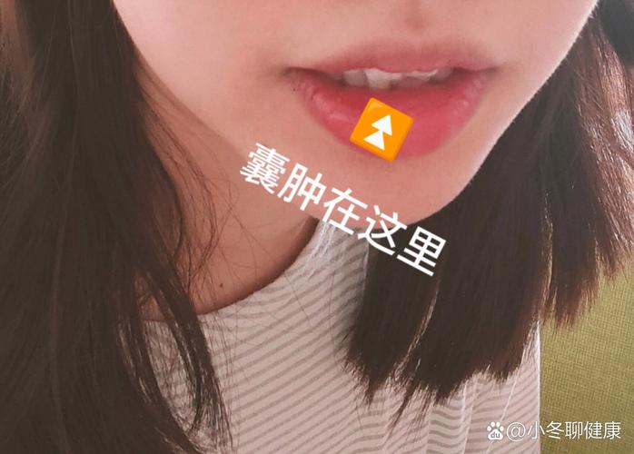 貓咪口腔健康，揭秘常見病——囊腫