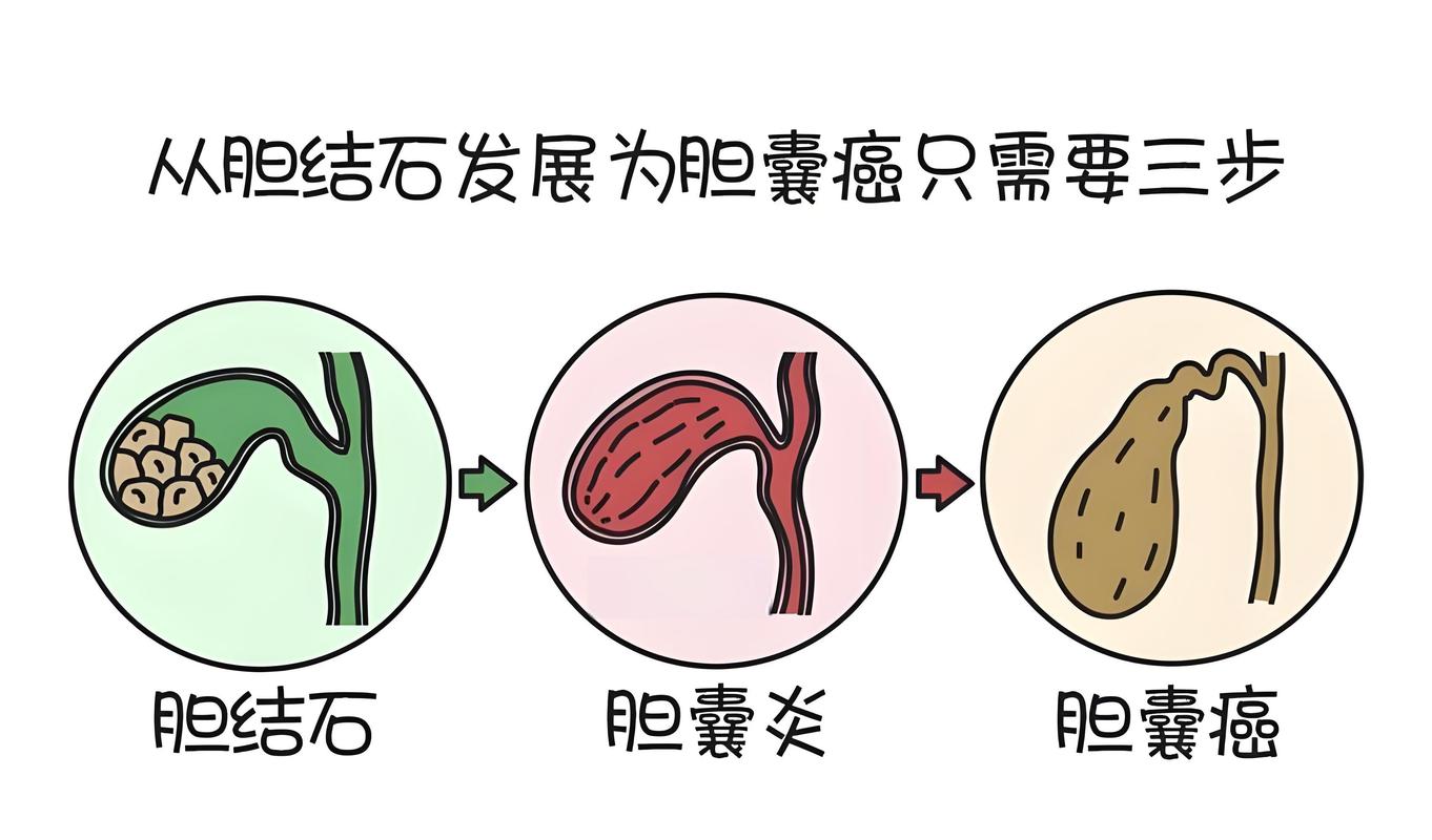 貓咪急性腹瀉，癥狀識(shí)別與應(yīng)對(duì)策略