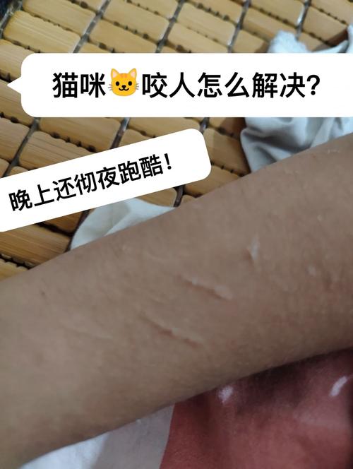 貓咪如何防止抓人，5個實用技巧