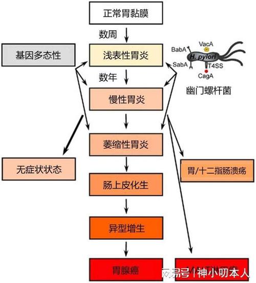 貓咪幽門梗阻，了解與應(yīng)對(duì)貓咪消化系統(tǒng)的常見問題