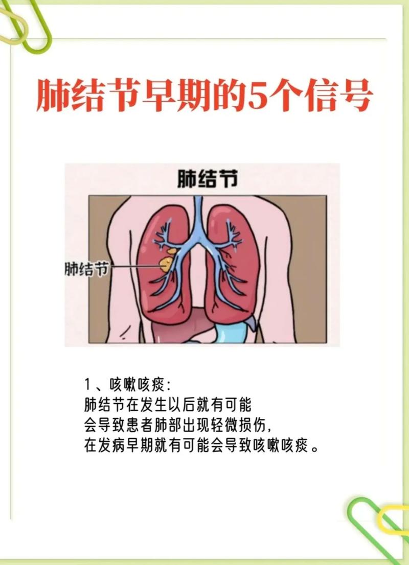 揭秘貓咪咳嗽與咳痰背后的秘密