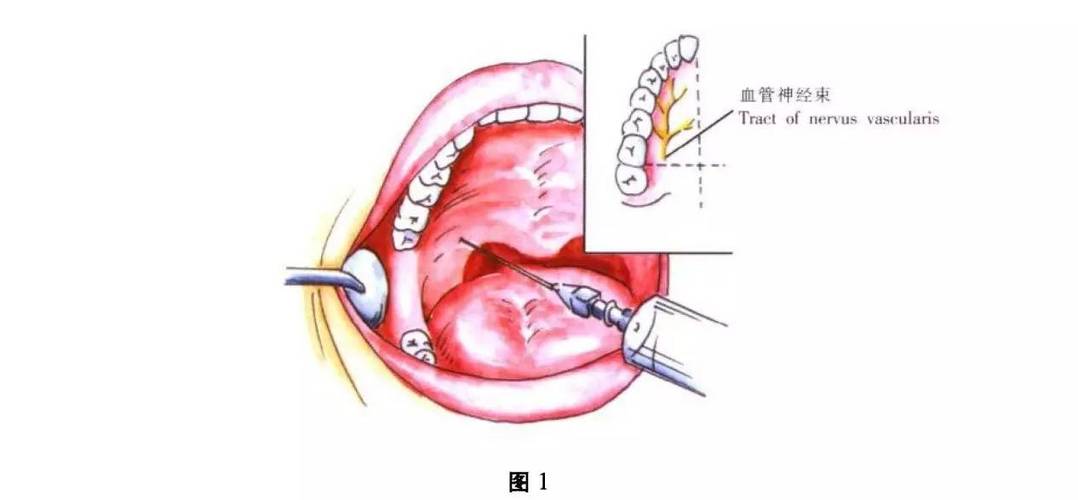 貓咪麻醉后的奇妙旅程——了解麻醉過(guò)程中的眼睛變化