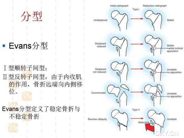 貓咪骨折治療費(fèi)用，綜合考量與預(yù)算規(guī)劃